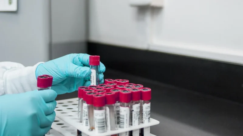 Gdzie zrobić badania hematologiczne na Bemowie?
